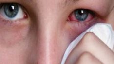 Göz Alerjisi Nedenleri ve Tedavisi