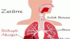 Zatürreden Korunmanın Yolları